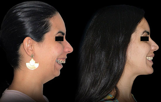 casos-3-2
